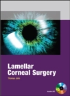 Lamellar Corneal Surgery - Book