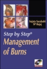 Step by Step Management of Burns - Book