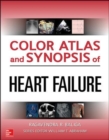 Color Atlas and Synopsis of Heart Failure - Book