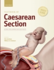 Textbook of Caesarean Section - Book