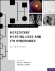 Hereditary Hearing Loss and Its Syndromes - eBook