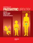 Essentials of Paediatric Urology - eBook