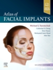 Atlas of Facial Implants - Book