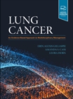 Lung Cancer E-Book : An Evidence-Based Approach to Multidisciplinary Management - eBook