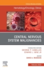 Central Nervous System Malignancies, An Issue of Hematology/Oncology Clinics of North America, E-Book : Central Nervous System Malignancies, An Issue of Hematology/Oncology Clinics of North America, E - eBook
