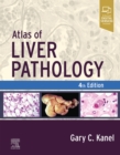 Atlas of Liver Pathology - E-Book - eBook