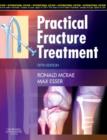 Practical Fracture Treatment - Book