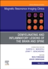 Demyelinating and Inflammatory Lesions of the Brain and Spine, An Issue of Magnetic Resonance Imaging Clinics of North America : Volume 32-2 - Book
