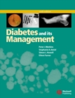 Diabetes and Its Management - eBook