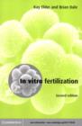 In Vitro Fertilization - eBook