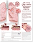 Chronic Obstructive Pulmonary Disease Anatomical Chart - Book