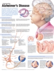 Understanding Alzheimer's Disease Anatomical Chart - Book