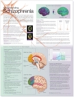 Understanding Schizophrenia Anatomical Chart - Book