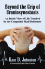 Beyond the Grip of Craniosynostosis : An Inside View of Life Touched by the Congenital Skull Deformity - Book