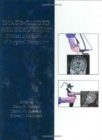 Image-Guided Neurosurgery - Book