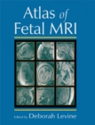 Atlas of Fetal MRI - eBook