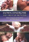 Down Syndrome DVD : The First 18 Months - Book