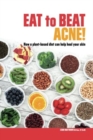 Eat to Beat Acne! : How a plant-based diet can help heal your skin. - Book