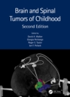 Brain and Spinal Tumors of Childhood - eBook
