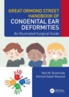 Great Ormond Street Handbook of Congenital Ear ?Deformities : An Illustrated Surgical Guide - eBook