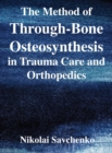 The Method of Through-Bone Osteosynthesis in Trauma Care and Orthopedics - Book