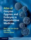 Atlas of Oocytes, Zygotes and Embryos in Reproductive Medicine Hardback with CD-ROM - Book