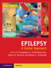 Epilepsy : A Global Approach - Book