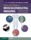 Pearls and Pitfalls in Musculoskeletal Imaging : Variants and Other Difficult Diagnoses - eBook