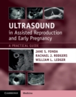 Ultrasound in Assisted Reproduction and Early Pregnancy : A Practical Guide - Book