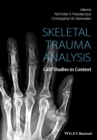 Skeletal Trauma Analysis : Case Studies in Context - Book
