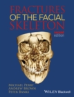 Fractures of the Facial Skeleton - eBook