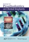 Journal of Prosthodontics on Dental Implants - eBook