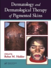 Dermatology and Dermatological Therapy of Pigmented Skins - eBook