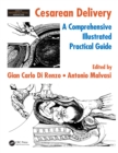 Cesarean Delivery : A Comprehensive Illustrated Practical Guide - eBook