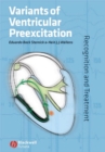 Variants of Ventricular Preexcitation : Recognition and Treatment - Book