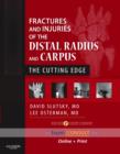 Fractures and Injuries of the Distal Radius and Carpus : The Cutting Edge - Book