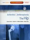 Arthritis and Arthroplasty: The Hip : Expert Consult - Online, Print and DVD - Book