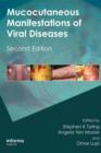 Mucocutaneous Manifestations of Viral Diseases : An Illustrated Guide to Diagnosis and Management - Book