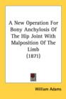 A New Operation For Bony Anchylosis Of The Hip Joint With Malposition Of The Limb (1871) - Book