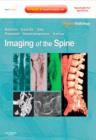 Imaging of the Spine E-Book : Expert Radiology Series - eBook