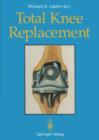 Total Knee Replacement - Book