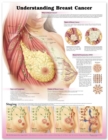 Understanding Breast Cancer 3E Paper - Book