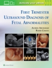 First Trimester Ultrasound Diagnosis of Fetal Abnormalities - Book