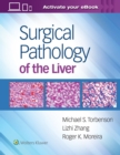 Surgical Pathology of the Liver - Book