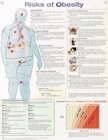 Risks of Obesity Anatomical Chart Laminated - Book