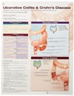 Ulcerative Colitis & Crohn's Disease Anatomical Chart Laminated - Book