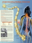Understanding Multiple Sclerosis Anatomical Chart - Book