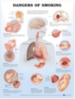 Dangers of Smoking Anatomical Chart - Book