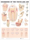 Disorders of the Teeth and Jaw Anatomical Chart - Book