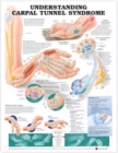 Understanding Carpal Tunnel Syndrome Anatomical Chart - Book